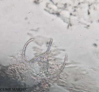 phyto/Brazilian_Amazon_coast/Amazomix_station_7/AMAZOMIX September 2021/Tripos brevis (Am_St7_r4_surf_Tripos_breve_20240819_114708)(copy)_thumb.jpg